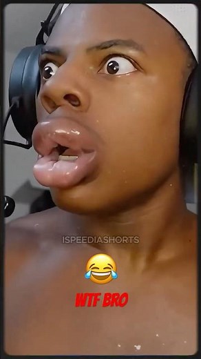 iShowSpeed Tries His New Kylie Jenner Lips 💋😂 #ishowspeed #challenge #edit