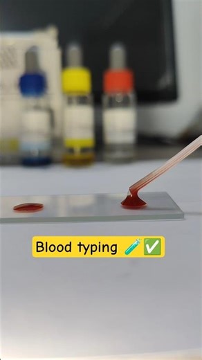 Blood typing 🩸 #bloodtype #viralvideo #shorts