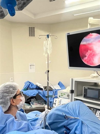 Septoplastia uterina por histeroscopia (procedimento de ressecação do septo uterino pela via minimamente invasiva)! #fellow #cirurgiaminimamenteinvasiva #histeroscopia #septoplastia