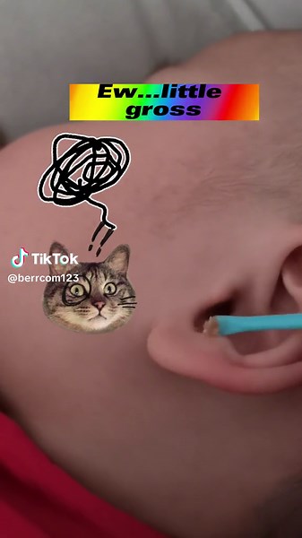 To clean the little one’s earwax👶💩👂a little tough🤣#foryou #babycare #momsoftiktok #familycare #earwax #healthcare #remove #kidsoftiktok #childrencare