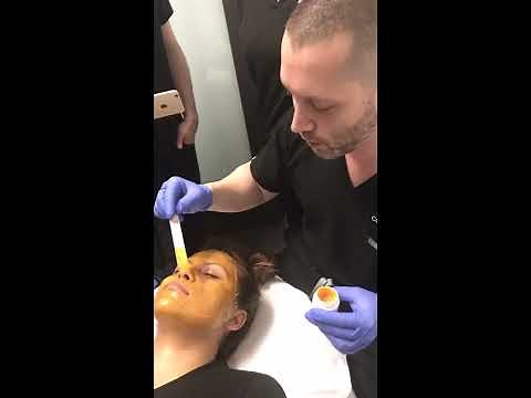 RevePeel Enlighten Mask | Depigmentation Peel for Melasma and Dark Skin Types | Live