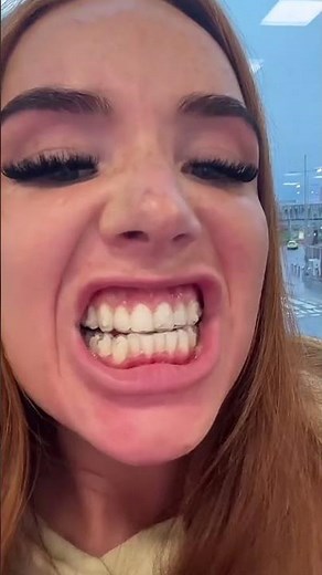 evolução do aparelho ortodôntico invisalign