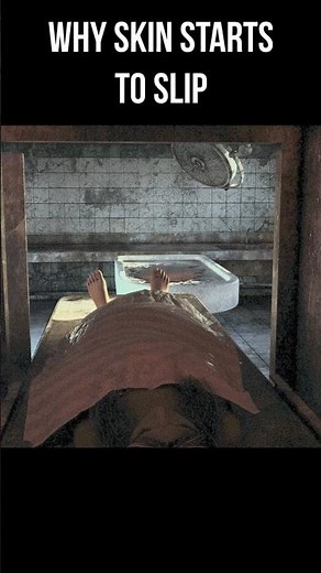 Why Skin Slips After Death | Stage 2 Decomposition Explained