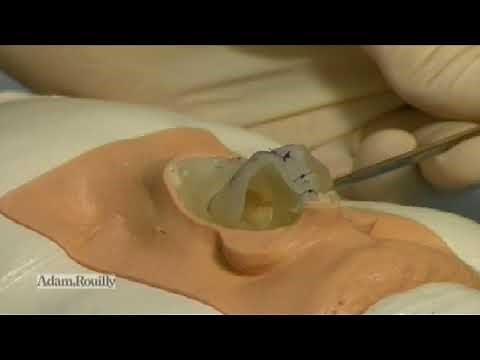 AR361 RHINOPLASTY SKILLS TRAINER