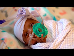 Saybie - World's smallest baby ever - weighs 245 grams
