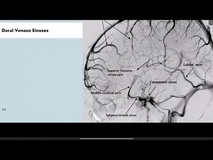 MASTERING ANGIOGRAMS FOR FRCR 1-PART 4