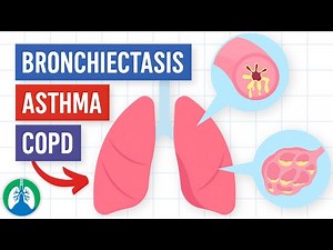 Bronchiectasis vs. Asthma vs. COPD | Comparison and Key Differences