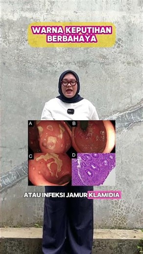 DANGEROUS VAGINAL DISCHARGE COLOR #education #healtheducation