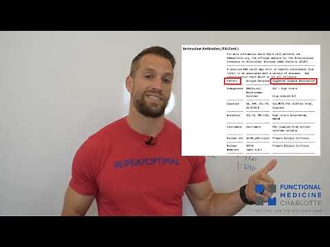 ANA positive - does that mean I have Lupus?