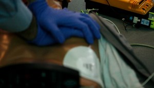 Intubation during CPR was associated with worse survival and brain health