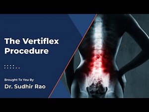 Vertiflex Treatment | Pain and Spine Specialists