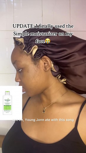 Experiencing Simple Moisturizer: My Skincare Journey