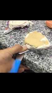 11K views · 346 reactions | Manual Vibration Machine  #Dentistry #LearningTips #BitesnBraces #Fun #Pakistan #medical #dentista #Dental | Bites & Braces Dental | Facebook