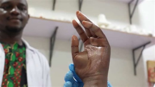 Nigerian firm develops breakthrough bionic arms for amputees