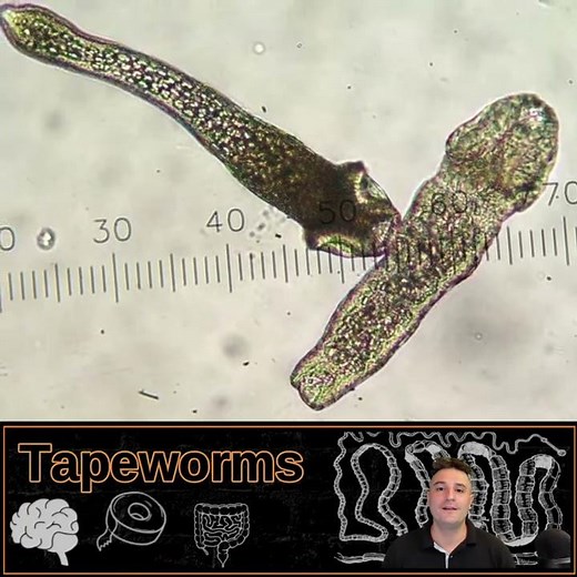 This animal is gross! | 5 Tapeworm Facts #shorts