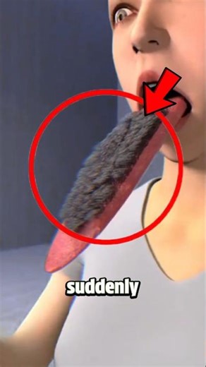 Why Your Tongue Suddenly Turns Dark, And Looks Hairy.