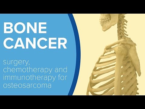 Osteosarcoma or Bone Cancer - Yale Medicine Explains