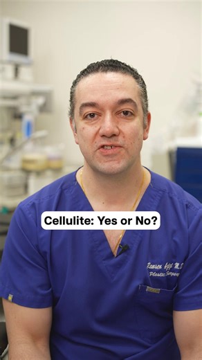 Cellulite, Yes or No? #celluite | cellulite