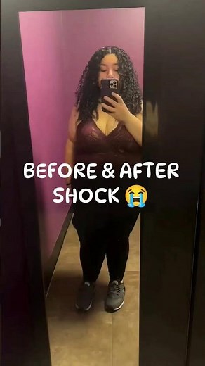 My Before & After After Losing 250 Pounds 😭🔥