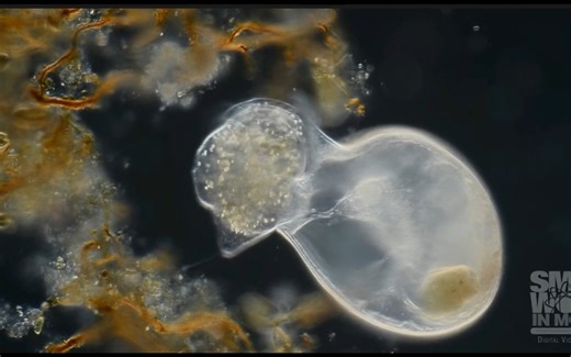 纤毛虫(Trachelius ciliate)吞噬猎物过程