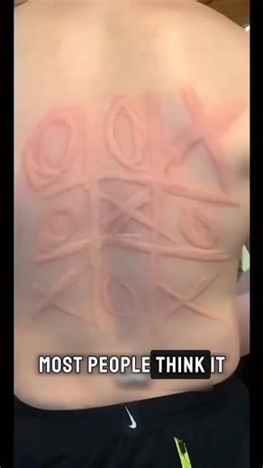 Why Rashes Suddenly Appear Even When Nothing Seems Wrong