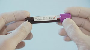 Covid-19 test in a lab tube - Free Stock Video