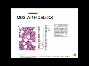Cytogenetics and Molecular Testing in MDS