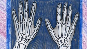 Why Knuckles Make a Popping Sound When Stretched