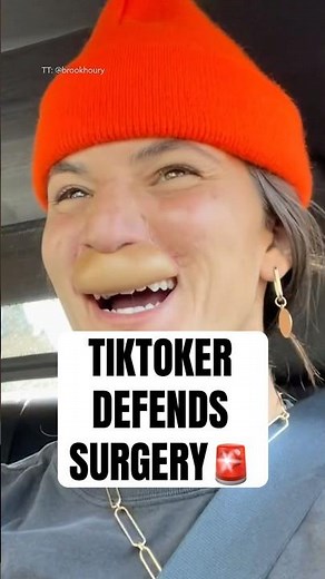 TikToker Defends Surgery #shorts #surgery #facesurgery