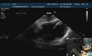 Bedside Sonography: The Focused 2D Echo