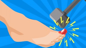 Why stubbing your toe hurts so much. | Insider Science