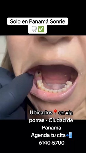 Innovación en Prótesis Dentales en Panamá