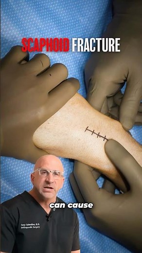 Commonly MISSED Wrist Fracture Can Cause Big Problems⁉️