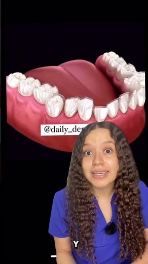 Alineadores invisibles los nuevos brackets | #odontologia #brackets #alineadoresinvisibles