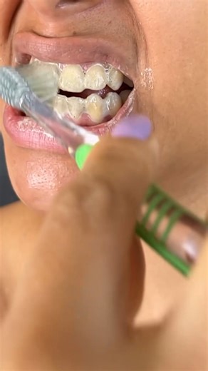 Dentists Will Be Furious That I'm Telling You This! | Top Tips