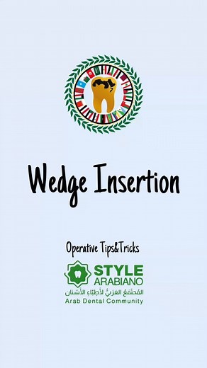 12K views · 85 reactions | Wedge insertion Operative Tips&Tricks Credit @dr__flamingo #stylearabiano #stylearabianoteam #Operative #wedge | Style Arabiano | Facebook