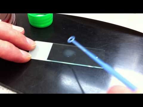 String test to differentiate Gram negative and positive bacteria.MOV