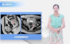 24-直肠及周围MR解剖
