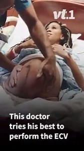 4.9K views · 87 reactions | If your baby is in a breech position...