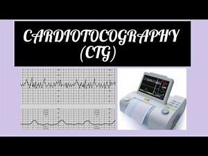 Cardiotocography (CTG INTERPRETATION) #gynaecology #obstetrician #labour #ctg