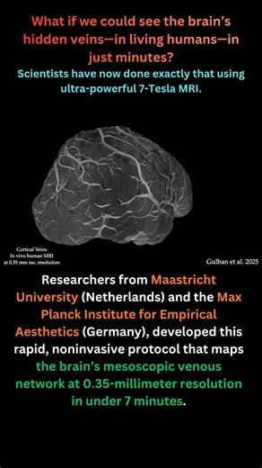 Whole-Brain Vein Mapping in Minutes: Fast 7-Tesla MRI Reveals Human Brain Microvasculature