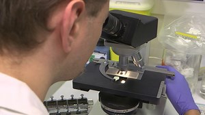 Adoptive Cell Transfer Technique