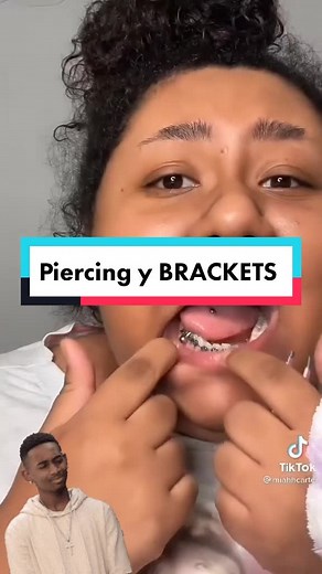 Piercings y brackets: ¿es seguro combinarlos?
