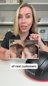 17K views · 91 reactions | #1 Rated Hair Regrowth Device. iRESTORE offers FDA-cleared devices that have helped 500,000+ people fight hair loss, including people who experienced the following: ✔️ Receding hairline ✔️ Bald spots ✔️ Thinning crown ✔️ Widening parts We offer a 12-month money-back guarantee because we know IT WORKS! Experience it for yourself  | iRESTORE Hair Growth System | Facebook