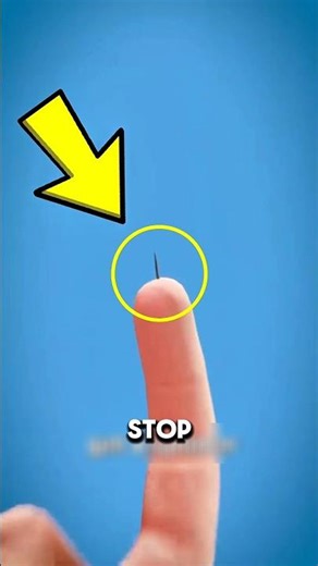 If you ever get a splinter… don’t pull it like this
