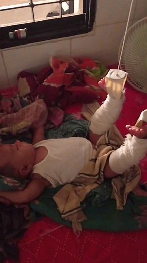 Gallows traction #newborn #hospital | Medical practice