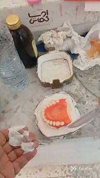 🔷 Quick guide to placing the upper denture in the mold. Subscribe for more! 🔷 #smilecraft #dentist