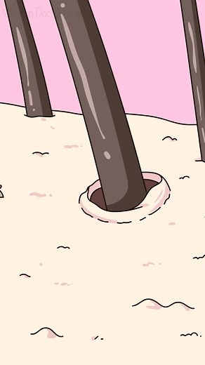 After putting on makeup & Eat before surgery.#bodyhealth #scienceexplained #animation #short #health #medicalfacts #humanbody #surgery #stomach #preoperative precautions #CloggedPores#PusPenules#AntimicrobialMileageImbalance#IncompleteMakeupRemovalExacerbatesProblems #FaceCare #AnimatedScience #Makeup# | Dr Health Care