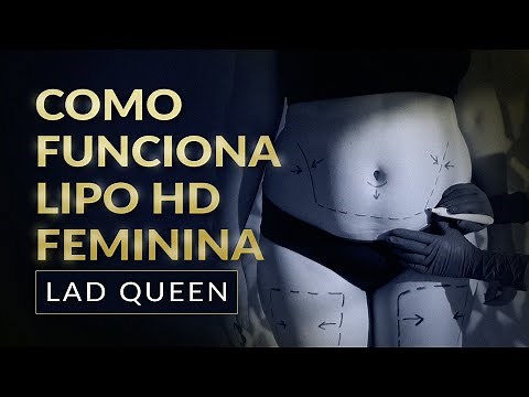 LIPO HD: COMO FUNCIONA E ANTES E DEPOIS