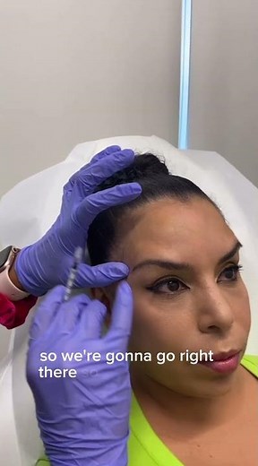 "Spock Brow" From Botox? EASY FIX